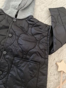 Siyah Kapitoneli Kapüşonlu Ceket